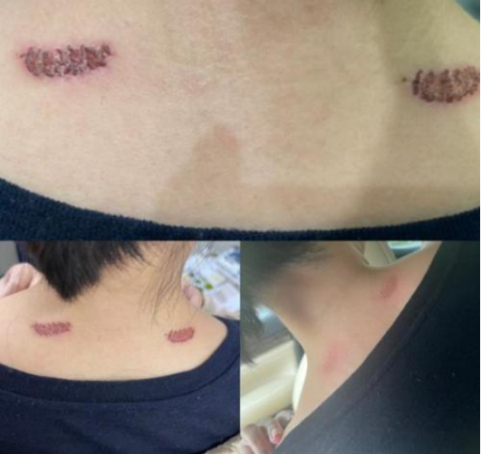 王一博代言网红按摩仪未来穿戴科技IPO，中专老板夫妻“掏空式”分红2.35亿